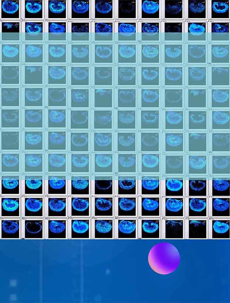 空间代谢组学（质谱成像）